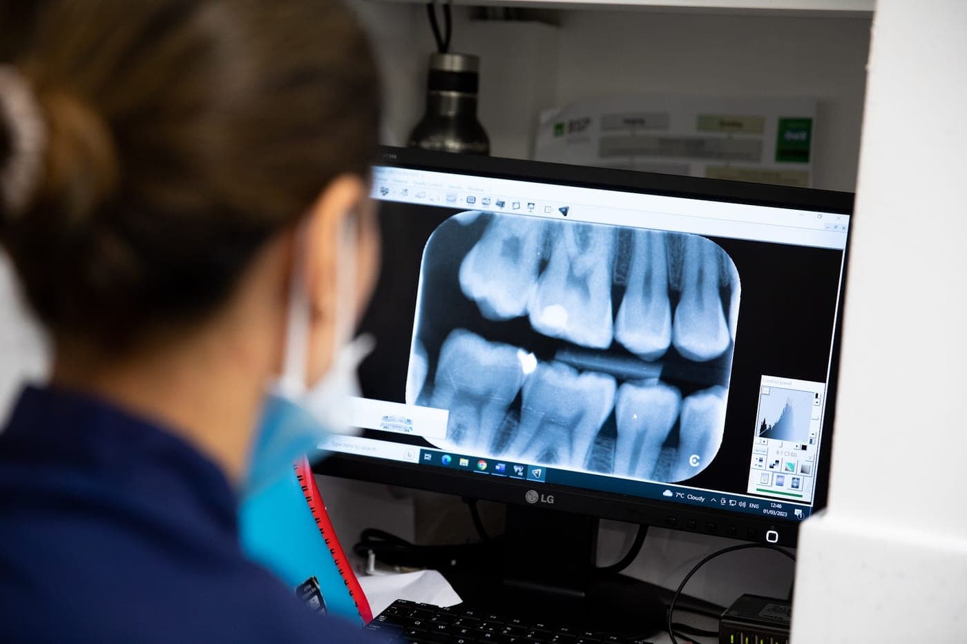 A Surrey Docks Dental clinician looking at a patient’s dental X-ray on screen